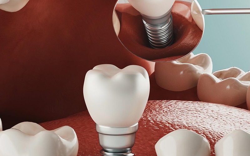 A Guide to Restorative Dentistry